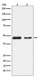 Anti-PDK2 Monoclonal Antibody