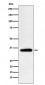 Anti-Pyruvate Dehydrogenase E1 beta subunit PDHB Monoclonal Antibody