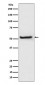 Anti-TXNIP Monoclonal Antibody