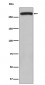 Anti-ATM Monoclonal Antibody