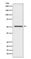 Anti-NR0B1 / DAX1 Monoclonal Antibody