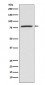 Anti-5 Lipoxygenase ALOX5 Monoclonal Antibody