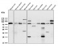 Anti-5 Lipoxygenase ALOX5 Monoclonal Antibody