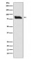 Anti-SMURF 2 Rabbit Monoclonal Antibody