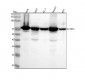 Anti-IMP3 IGF2BP3 Monoclonal Antibody