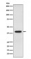 Anti-SET Monoclonal Antibody