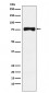 Anti-TRP1 Monoclonal Antibody