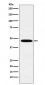 Anti-Wnt2b Monoclonal Antibody