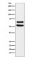 Anti-Ikaros Monoclonal Antibody