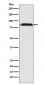 Anti-Furin Monoclonal Antibody