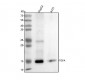 Anti-TGF alpha Monoclonal Antibody