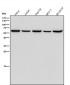 Anti-Retinoic Acid Receptor beta RARB Monoclonal Antibody