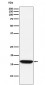 Anti-NM23A Monoclonal Antibody