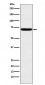 Anti-Heparanase 1 HPSE Monoclonal Antibody