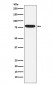 Anti-IKBKE Monoclonal Antibody