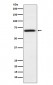 Anti-PMP70 ABCD3 Monoclonal Antibody
