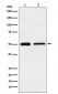 Anti-TIM1 HAVCR1 Monoclonal Antibody