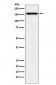 Anti-Desmoglein 2 Monoclonal Antibody