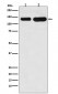 Anti-K-Cadherin-6 CDH6-Monoclonal Antibody