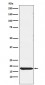 Anti-TSH beta Rabbit Monoclonal Antibody