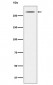 Anti-Thyroglobulin TG Monoclonal Antibody