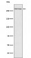 Anti-Thyroglobulin TG Monoclonal Antibody