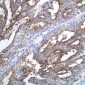 Anti-CA125 / MUC16 Monoclonal Antibody