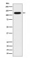 Anti-Cadherin 16 CDH16 Monoclonal Antibody