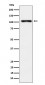 Anti-TPO Monoclonal Antibody