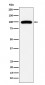 Anti-CD10 MME Monoclonal Antibody