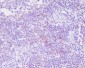 Anti-CD25 IL2RA Monoclonal Antibody