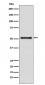 Anti-TDT DNTT Monoclonal Antibody