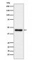 Anti-ABHD5 Monoclonal Antibody