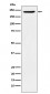 Anti-PBRM1 Rabbit Monoclonal Antibody