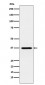 Anti-CRX Monoclonal Antibody