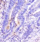 Anti-ADA Antibody Picoband™ (monoclonal, 6D4)