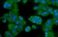 Anti-CA2 Antibody Picoband™ (monoclonal, 10E11)