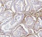 Anti-Collagen III/COL3A1 Antibody Picoband™ (monoclonal, 9H9)