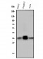 Anti-PPT1 Antibody Picoband™ (monoclonal, 10F3)