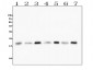 Anti-Cofilin 2/CFL2 Antibody Picoband™ (monoclonal, 8C13)
