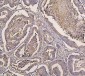 Anti-IRS1 Antibody Picoband™ (monoclonal, 10I3)