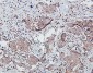 Anti-SDHB Antibody Picoband™ (monoclonal, 2I3)