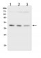 Anti-SDHB Antibody Picoband™ (monoclonal, 2I3)