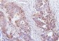 Anti-SQSTM1/p62 Antibody Picoband™ (monoclonal, 3H11)