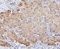 Anti-SQSTM1/p62 Antibody Picoband™ (monoclonal, 3H11)