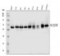 Anti-SQSTM1/p62 Antibody Picoband™ (monoclonal, 3H11)