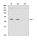 Anti-SDHB Antibody Picoband™ (monoclonal, 11I3)