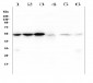 Anti-Desmin Antibody Picoband™ (monoclonal, 2B5)