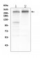 Anti-Tuberin TSC2 Antibody Picoband™ (monoclonal, 6I3)