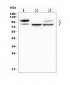 Anti-GAA Antibody Picoband™ (monoclonal, 2G7)